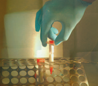 adhere academy: premixed and frozen adhesives