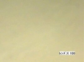 THINKY 100 x magnification after curing